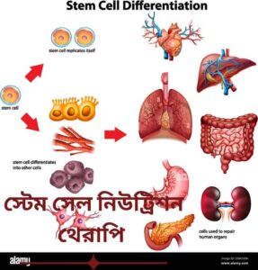 আপনি কি আসলে ডায়াবেটিক-মুক্ত জীবনযাপন করার ইচ্ছুক?